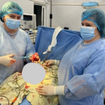 На Волині жінці видалили велику пухлину матки, зберігши можливість стати мамою