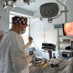 У лікарні на Волині пацієнту видалили великі камені з жовчного міхура через незначні розрізи