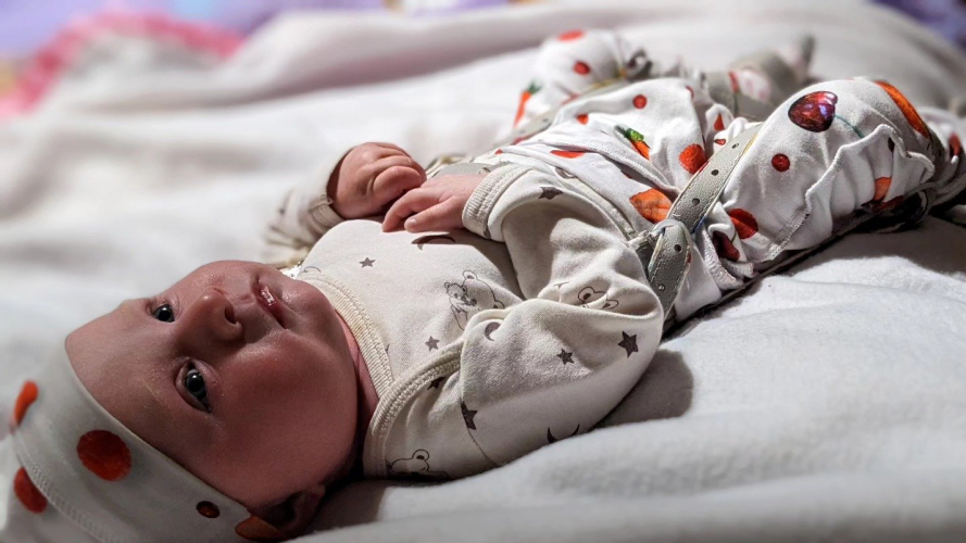 З народження бореться за життя: маленька лучанка потребує допомоги