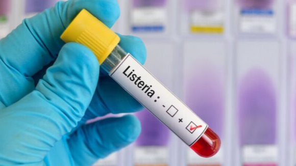 На Волині у новонародженої дитини виявили небезпечну інфекцію