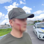 На Волині невідомий вдарив лопатою працівника ТЦК